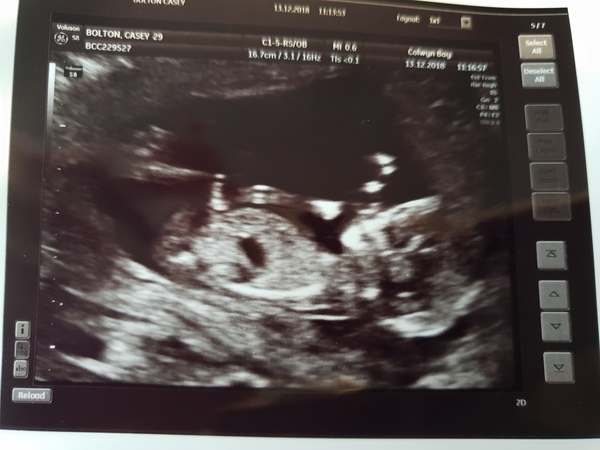 13 weeks 4 days, gender guess?