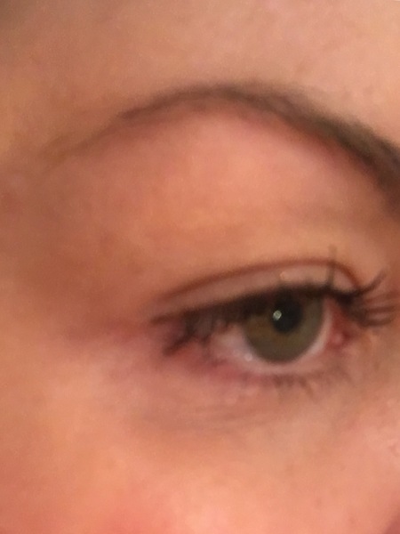Having a Botox eyebrow lift soon!
