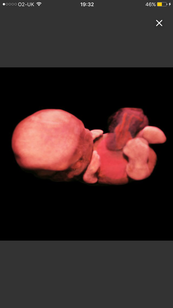 July 2019 Part 4 - Still in the 1st Trimester