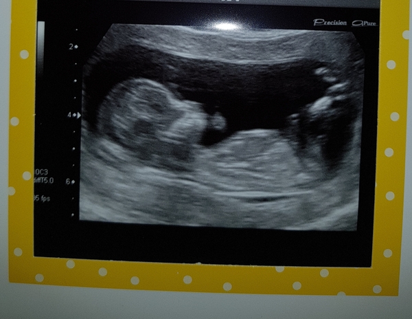 June 2019 Thread 4 - sliding towards 2nd trimester