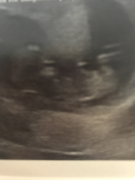 June 2019 Thread 4 - sliding towards 2nd trimester