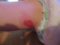 Should I complain to Tesco about this?  (Graphic picture warning)