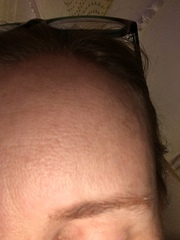 What can I do to my open pores?!