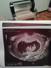 July 2019 Part 4 - Still in the 1st Trimester