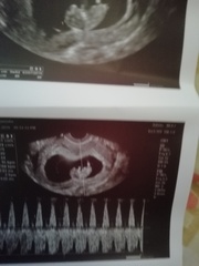 July 2019 Part 4 - Still in the 1st Trimester