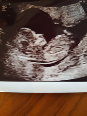 June 2019 Thread 4 - sliding towards 2nd trimester