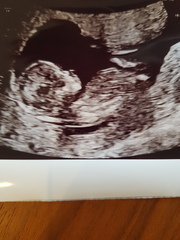 June 2019 Thread 4 - sliding towards 2nd trimester