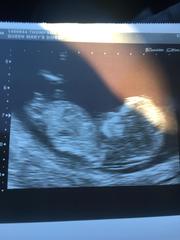 Girl or Boy