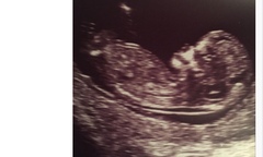 Boy or girl?! Any guesses - find out Xmas eve!