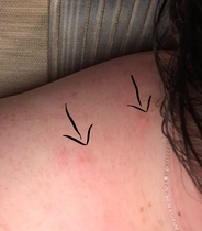Being bitten