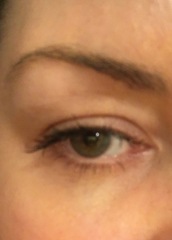 Having a Botox eyebrow lift soon!