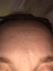 What can I do to my open pores?!