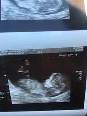 Girl or Boy