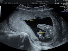 First baby due June 2019!