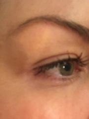 Having a Botox eyebrow lift soon!