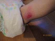 Should I complain to Tesco about this?  (Graphic picture warning)