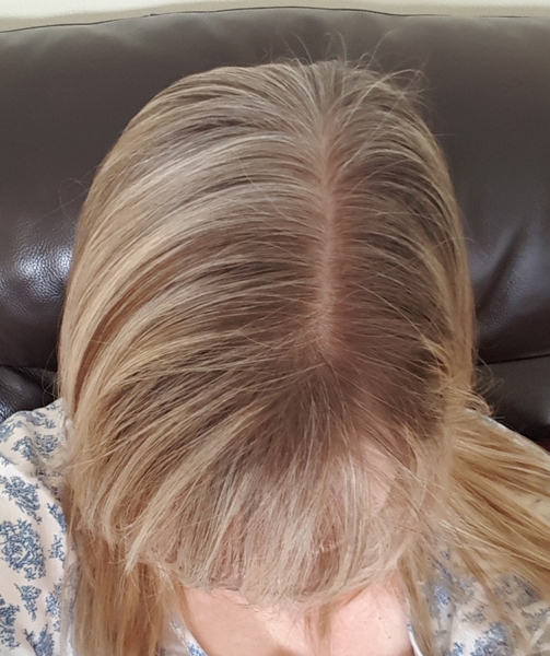 What’s the best way to cover these grey hairs? Pics attached