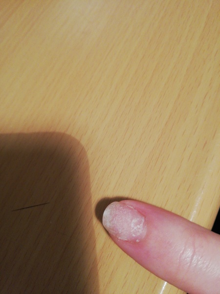 Best way to hide this? (Nail related)
