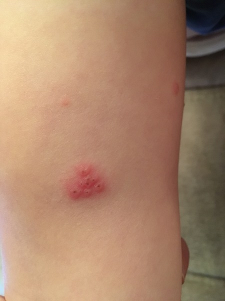 Can u help identify these spots?