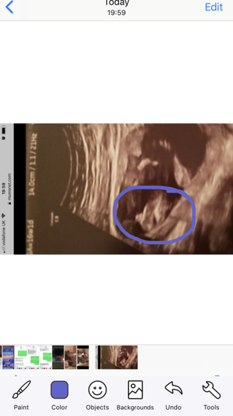 Potty shot help, confirmed both boy and girl!!