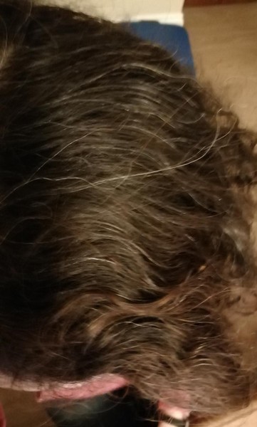 Hair help - I need a 10 yr plan...