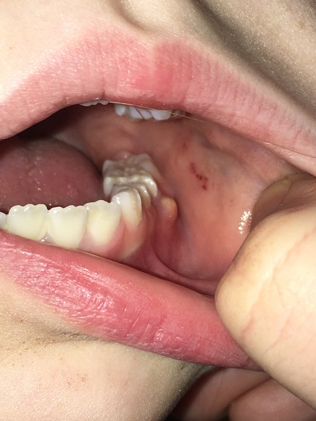 Any dentist/dental nurse around to look at this?