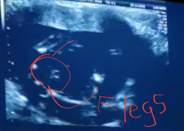 boy or girl?