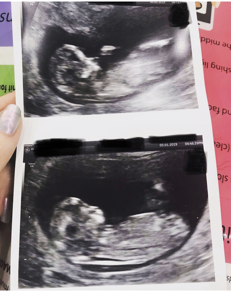 Gender Guesses / Nub Theory