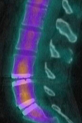 Most serious injury you have ever had in your life?