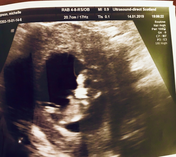 IVF July/August 2018