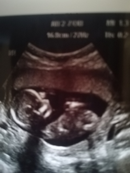 July 2019 (thread 7)