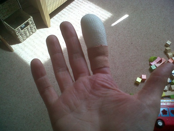 Most Ridiculous Injury you have ever had in your life?