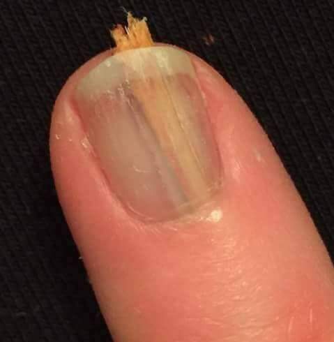 To think this is one of the most painful things you can do.