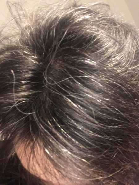 Is anyone going grey this year?