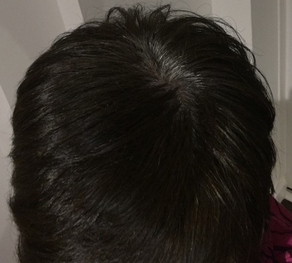 Will Olaplex help dye my very dark hair white?