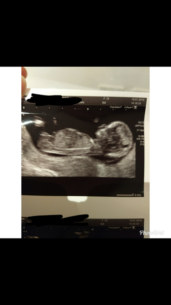 July 2019 (thread 7)