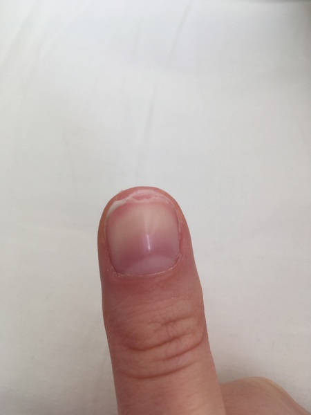 How to improve my nails?