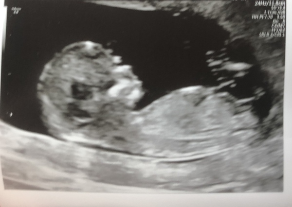 Ringing in the New Year & 2nd trimester - July 2019!