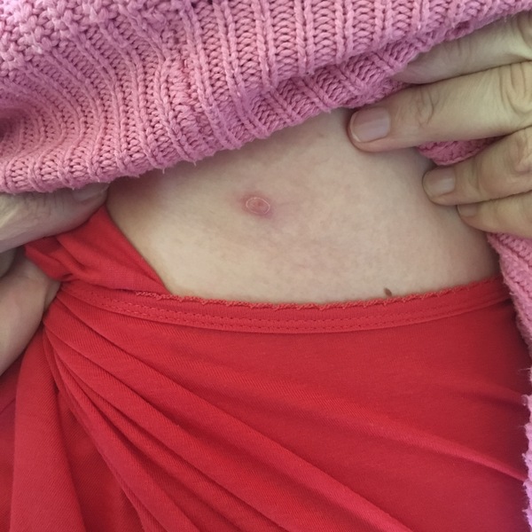 Honestly this is not a nipple