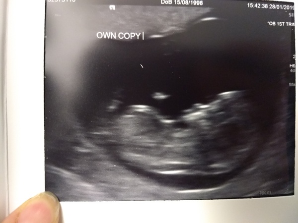 August 2019 4: All the scans and hopefully the end of nausea