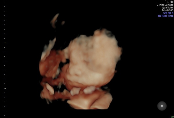 Due in March and so bored.