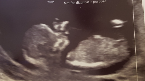 August 2019 4: All the scans and hopefully the end of nausea