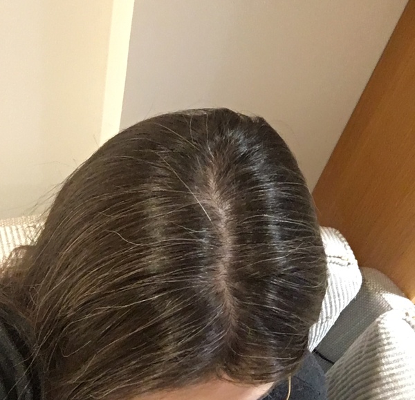 Is anyone going grey this year?
