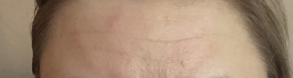 🐌 Fantastic Skincare: We're So Drunk We're Seeing Elephants 🐘