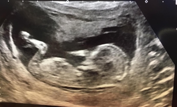 Sex guesses? Scan on Saturday!