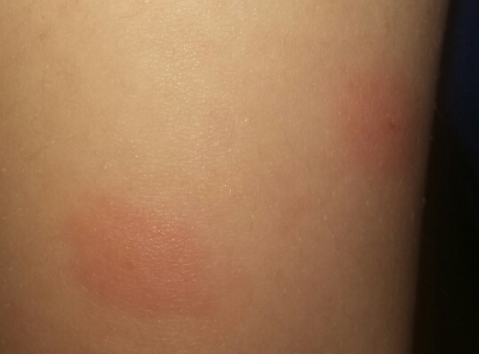 Can anyone identify these bites before I burn my house down!