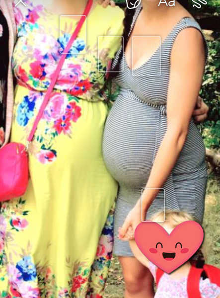 Is the Duchess of Sussex expecting twins?