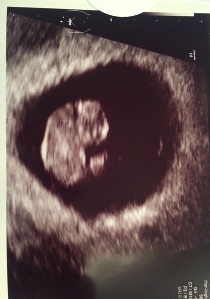 September 2019 babies?