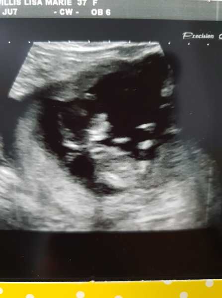 August 2019 4: All the scans and hopefully the end of nausea