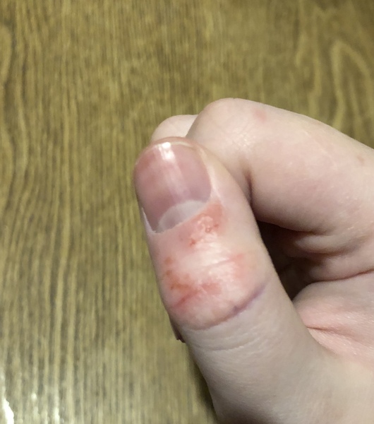 Any ideas on skin condition please (picture)